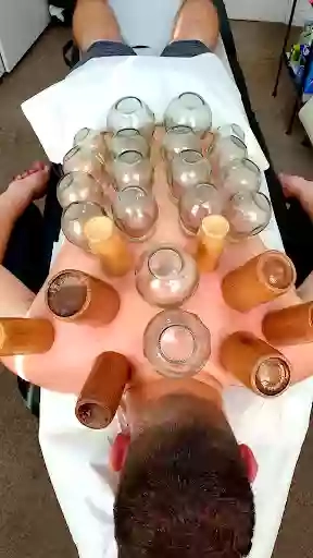 Mubarak Cupping Therapy