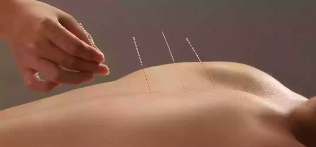 Acupuncture for Life