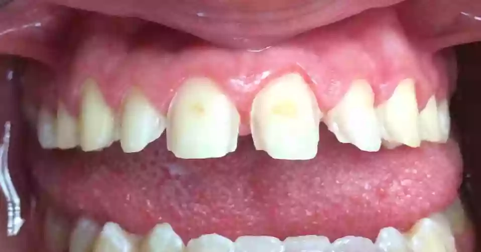 Dentista Scafati - DS Odontoiatria