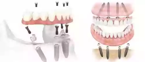 Dentista Torino - Ventura Centri Odontoiatrici