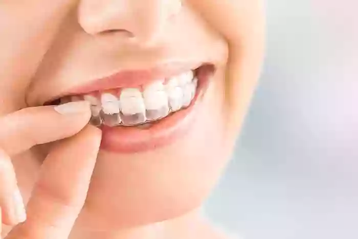 Invisalign - Aparat ortodontyczny Gdansk