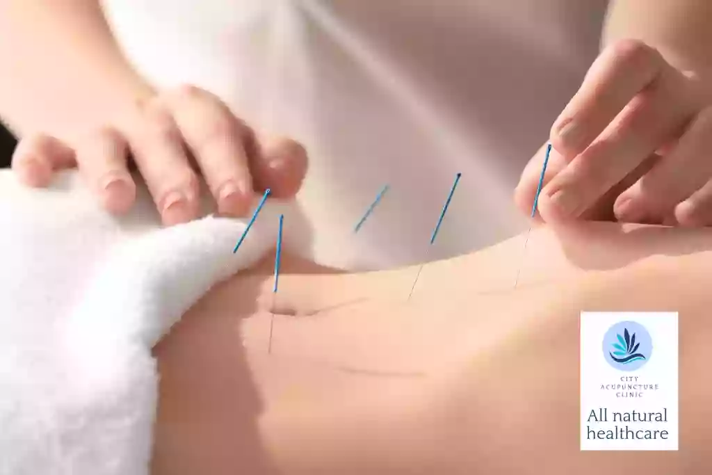 Adelaide City Acupuncture Pain Clinic