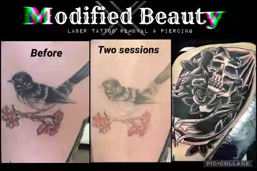 Modified Beauty-Laser Tattoo removal & Piercing