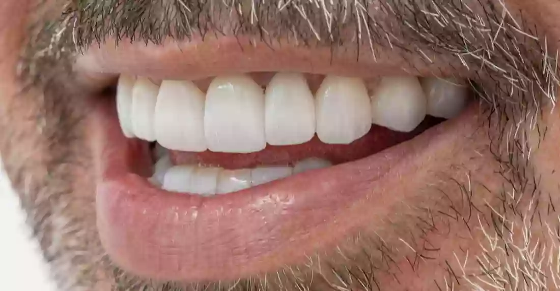 Amazing Smiles Jimboomba Dentist