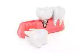 Clínica Dental Eola