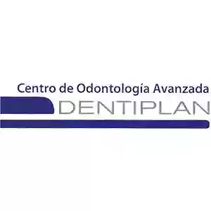 Dentiplan