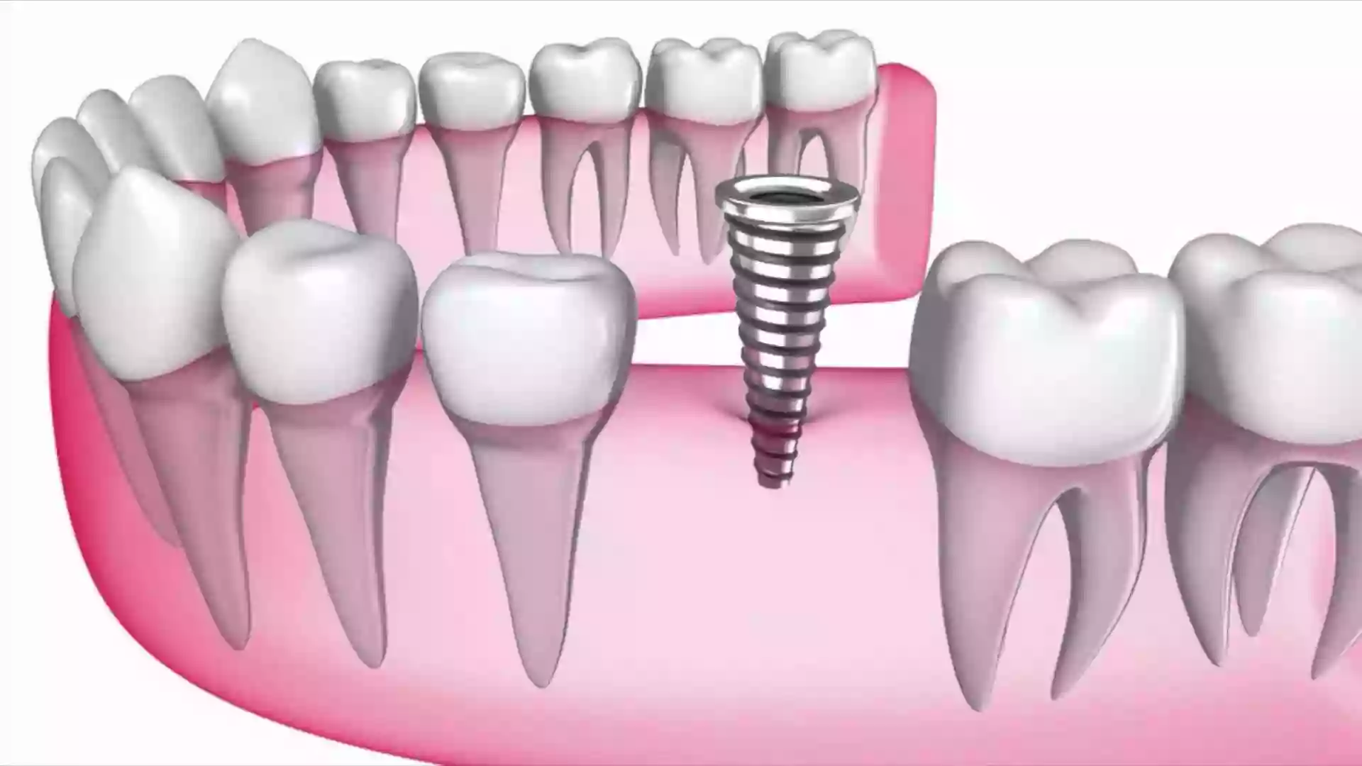 CENTRO IMPLANTOLÓGICO QUIRUTECH