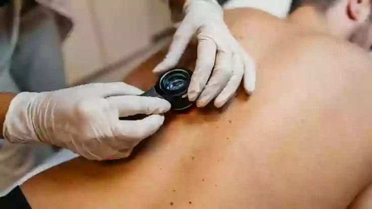 Centre de téléexpertise en dermatologie interventionnelle