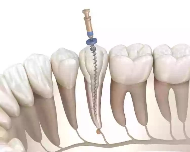 Centre Dentaire Baudelaire Charenton Dentelia