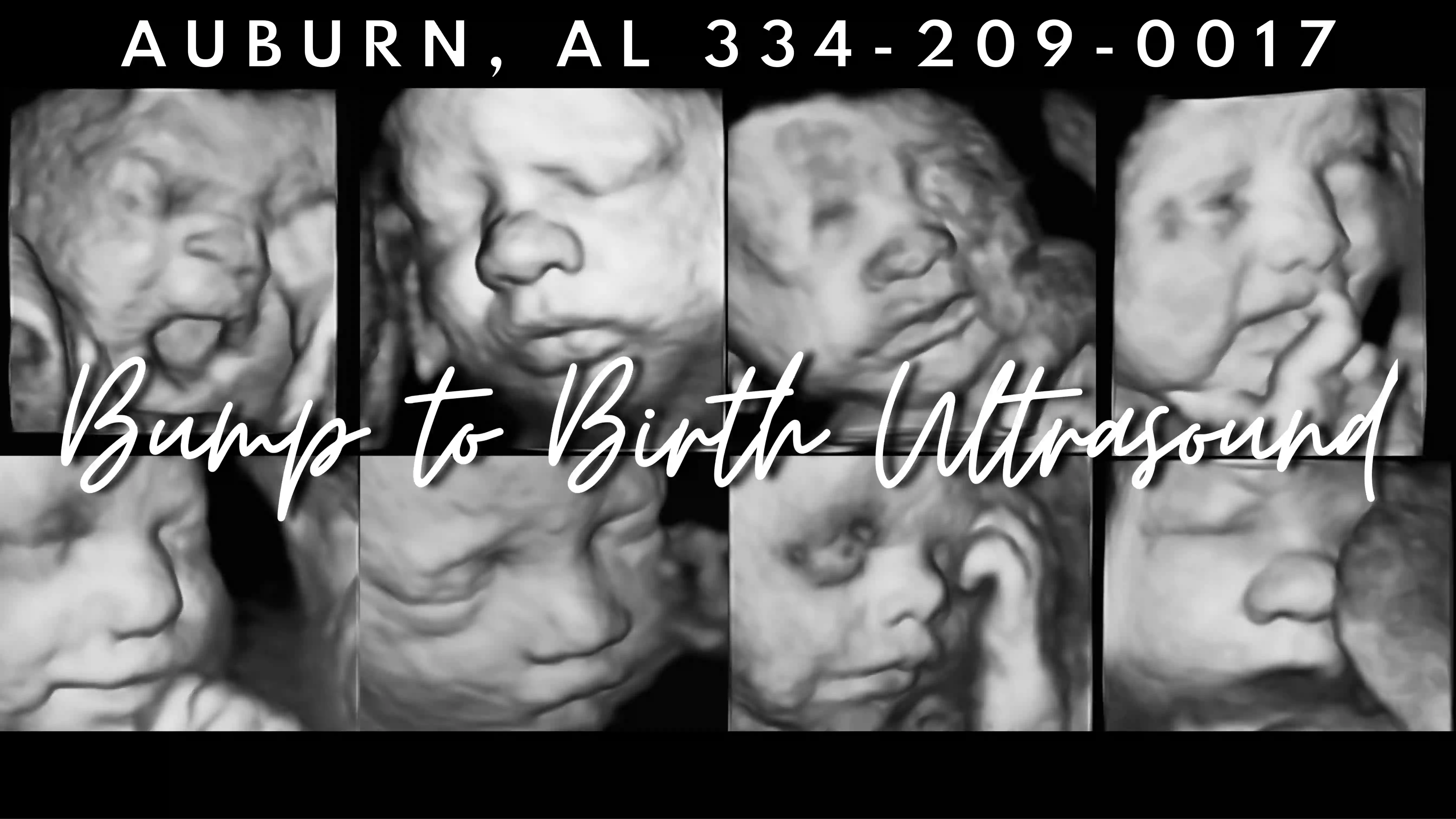 Bump to Birth Ultrasound- 3D/4D/HD Ultrasound