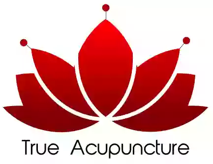 True Acupuncture Chandler