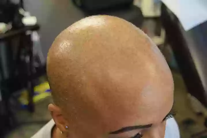 Scalp Micropigmentation