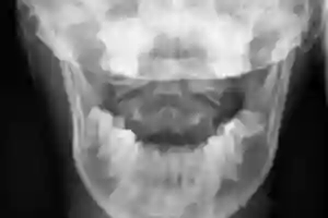 Norcal Cranio Facial - Dr. Dwight E. Jennings, T.M.J, DDS