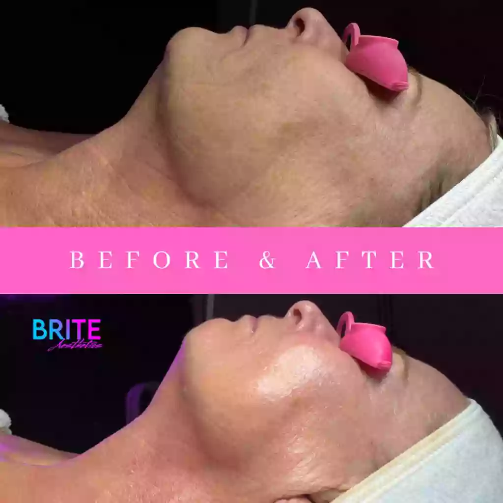 Brite Aesthetics