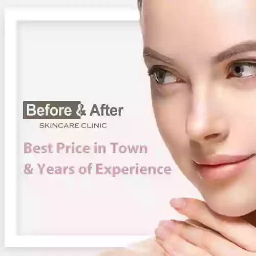 Before & After Skincare Clinic