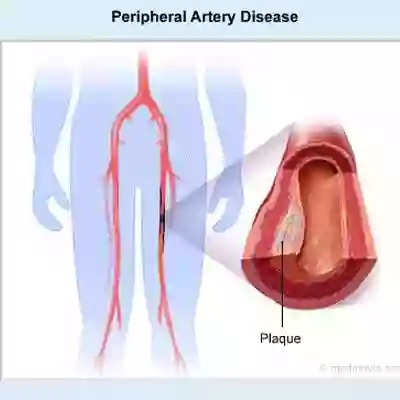 Central Coast Comprehensive Cardiovascular Imaging