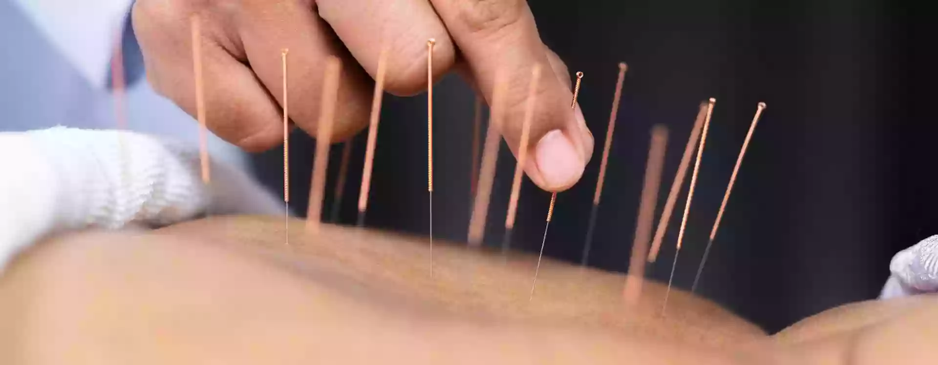 Clear Path Acupuncture