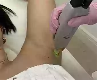 SKINFETCH LASER CLINIC