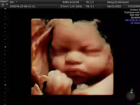 Baby Dimensions 3D 4D & HD LIVE Imaging Studio