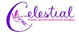 Celestial Plastic and Reconstructive Surgery