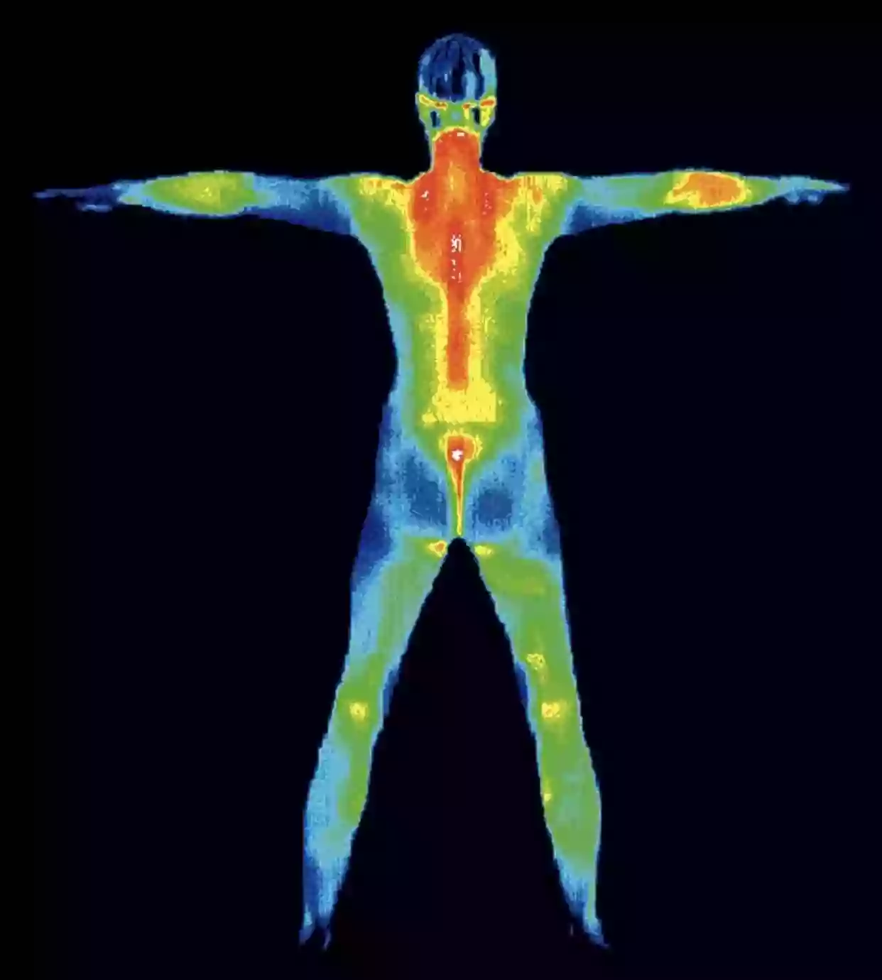 Advantage Scan Thermography