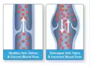 Vascular Institute of the Midwest