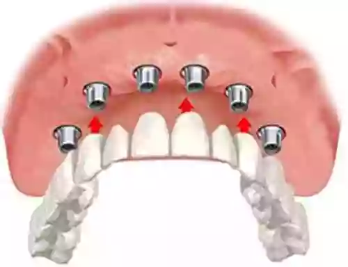 Dental Implant & Denture Clinic