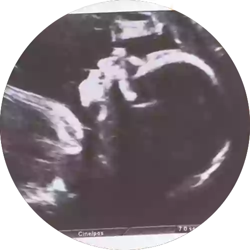 Love at First Sight Ultrasound - 3D/4D/HD