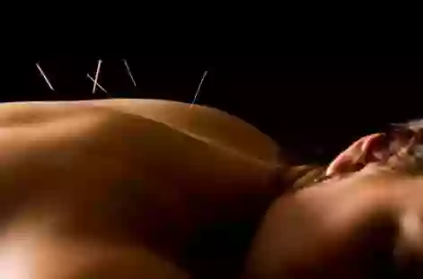 Alexander Wolf Acupuncture