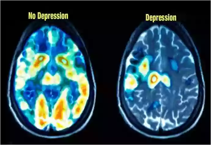 TMS Institute of Great Plains Mental Health