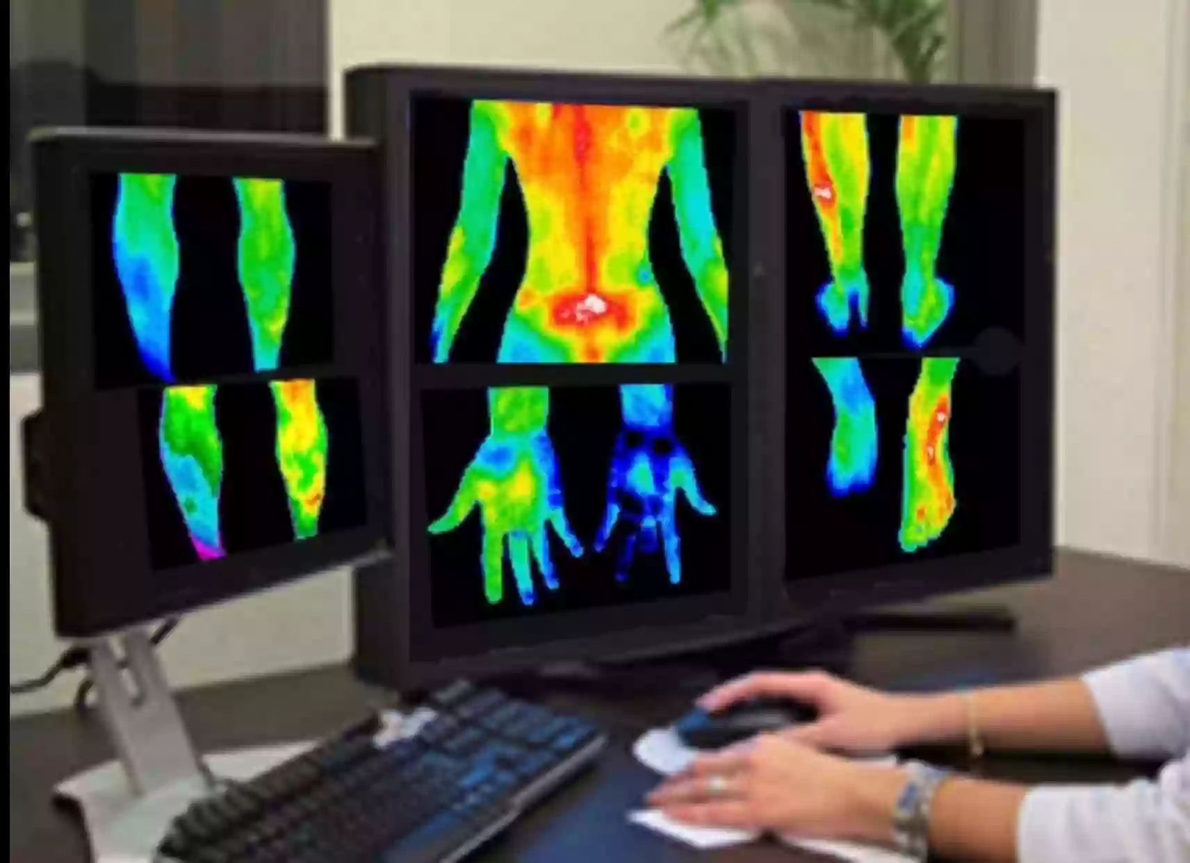 Safe Body Imaging Thermography