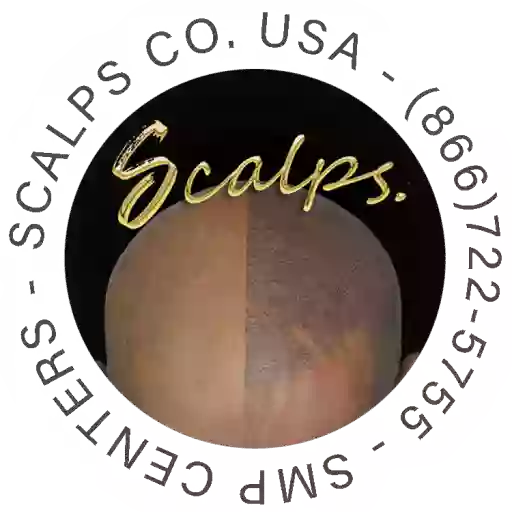 SCALPS | Scalp Micropigmentation Centers