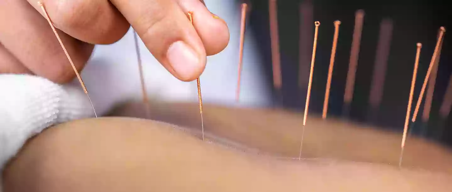 Infinity Acupuncture