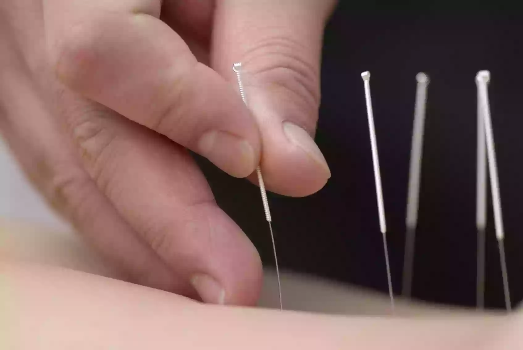 Patrick Giguère, Licensed Acupuncturist