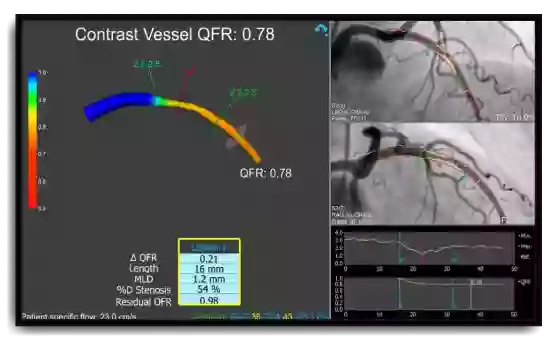 Medis medical imaging systems