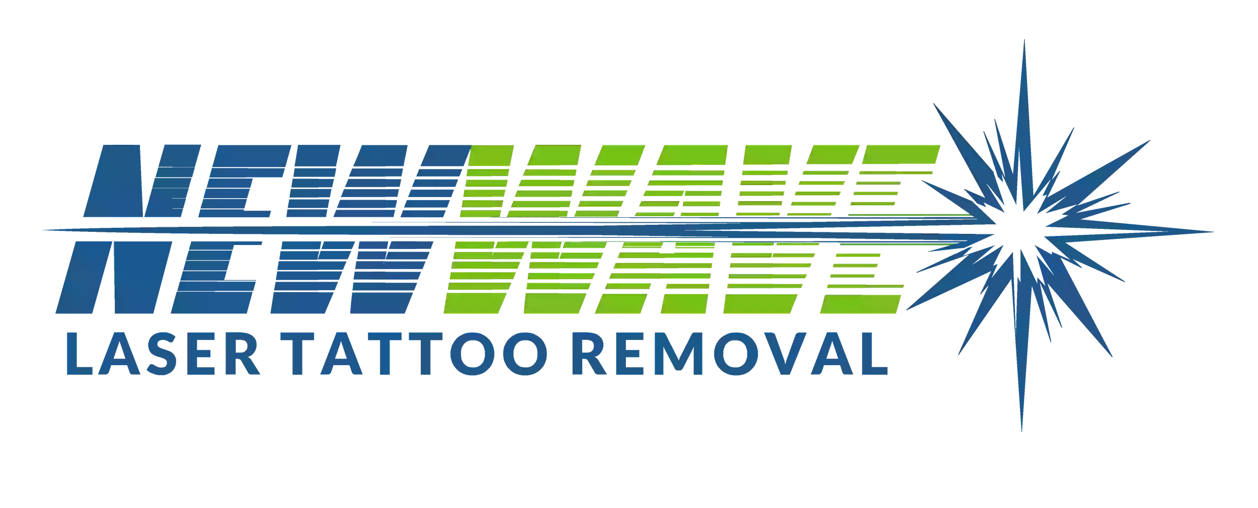 New Wave Laser Tattoo Removal