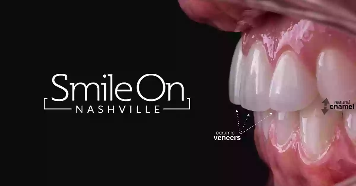 Smile on Nashville