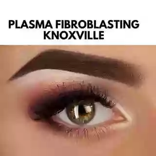 Plasma Fibroblasting Knoxville