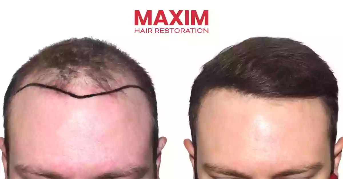 MAXIM Hair Restoration & Transplants - San Antonio