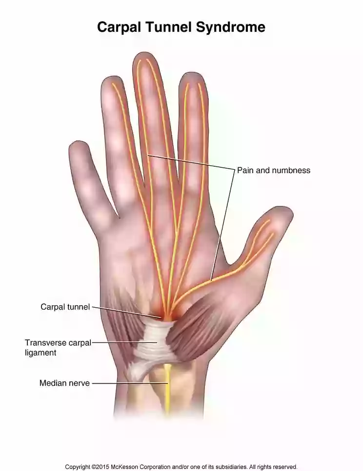 Neurology of Sugar Land, PLLC