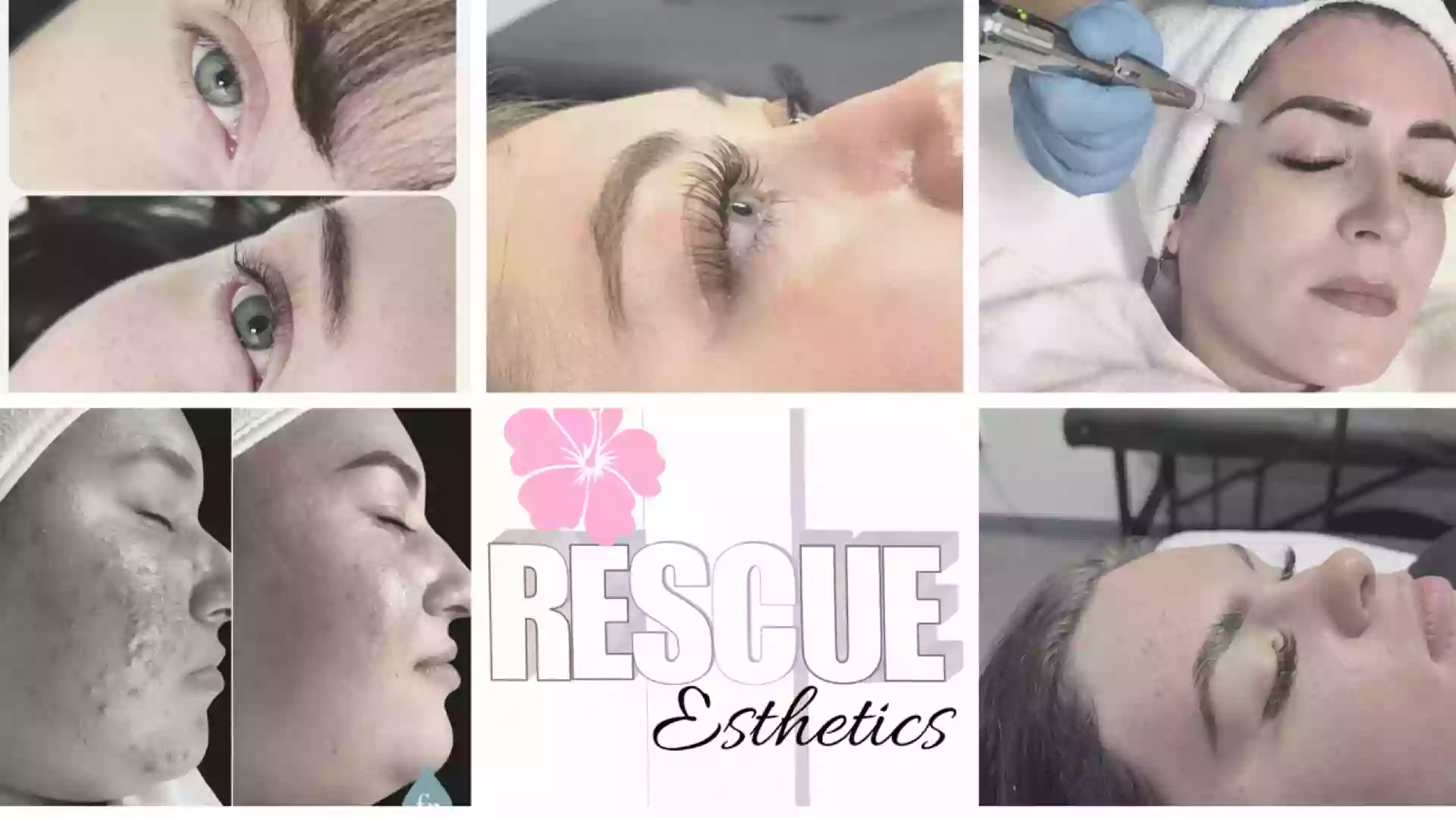 Rescue Esthetics