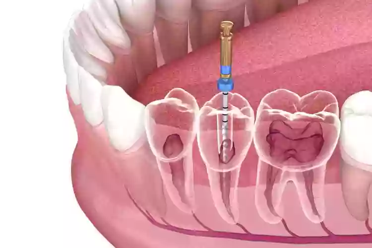 Dental Health Endodontics - University Clinic